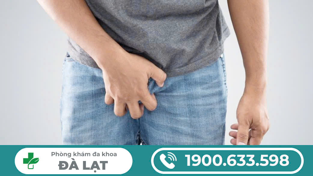 Hình ảnh minh họa